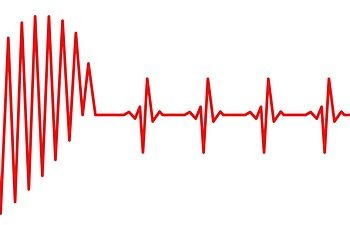 Private patients ‘20% less likely’ to die after cardiac surgery, academics find