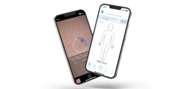 Medicash renews SkinVision partnership